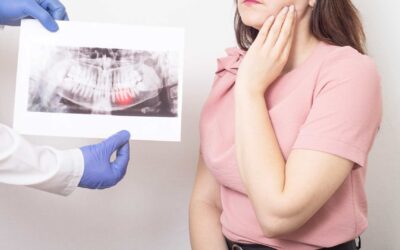 Why Do I Need My Wisdom Teeth Removed?