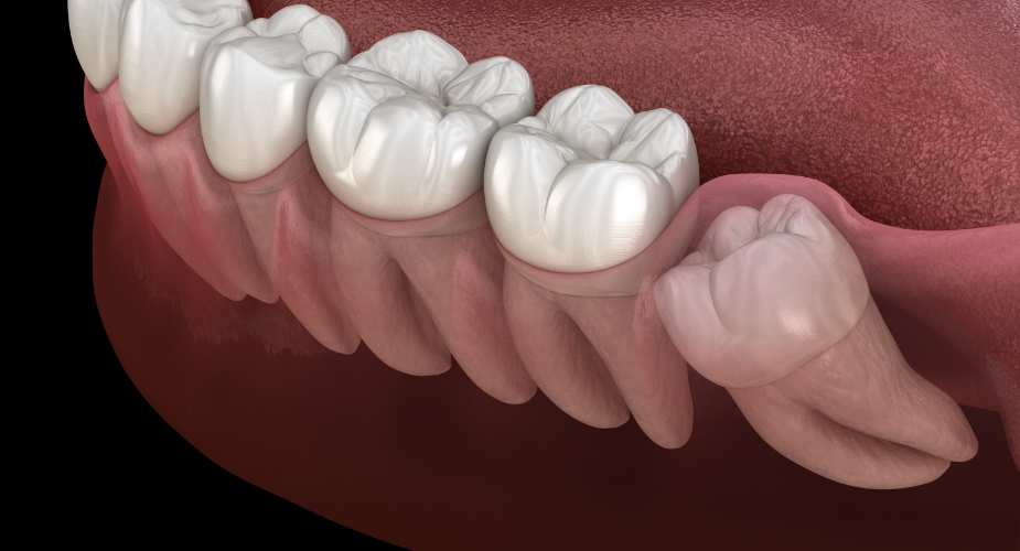 heal cut swollen gums dentist